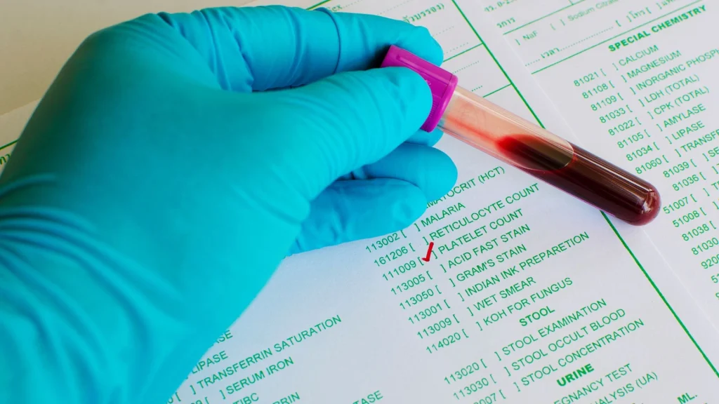 Platelet aggregometer adalah alat laboratorium khusus yang digunakan untuk mengukur kemampuan trombosit dalam membentuk agregasi.