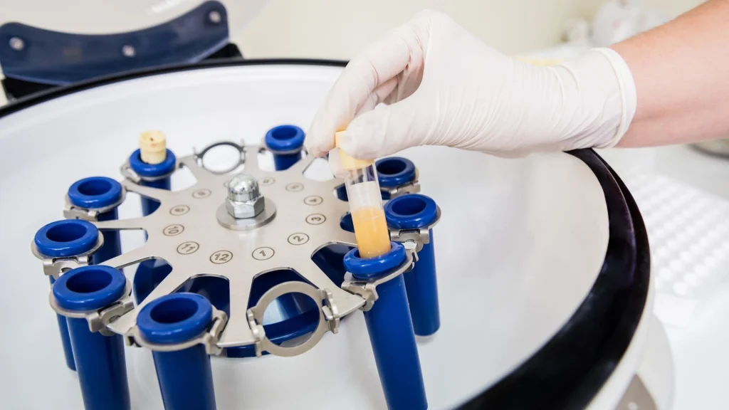 Terapi antiplatelet merupakan bagian penting dalam pengobatan dan pencegahan penyakit kardiovaskular seperti serangan jantung dan stroke.