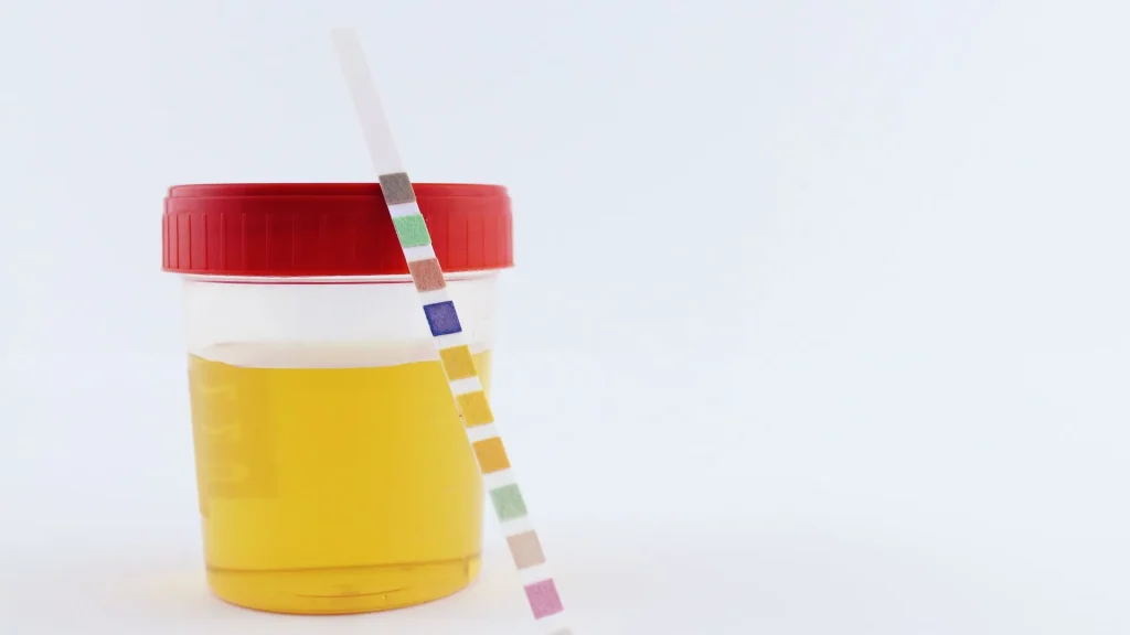 Infeksi saluran kemih (ISK) adalah salah satu penyakit yang umum terjadi pada pria maupun wanita.