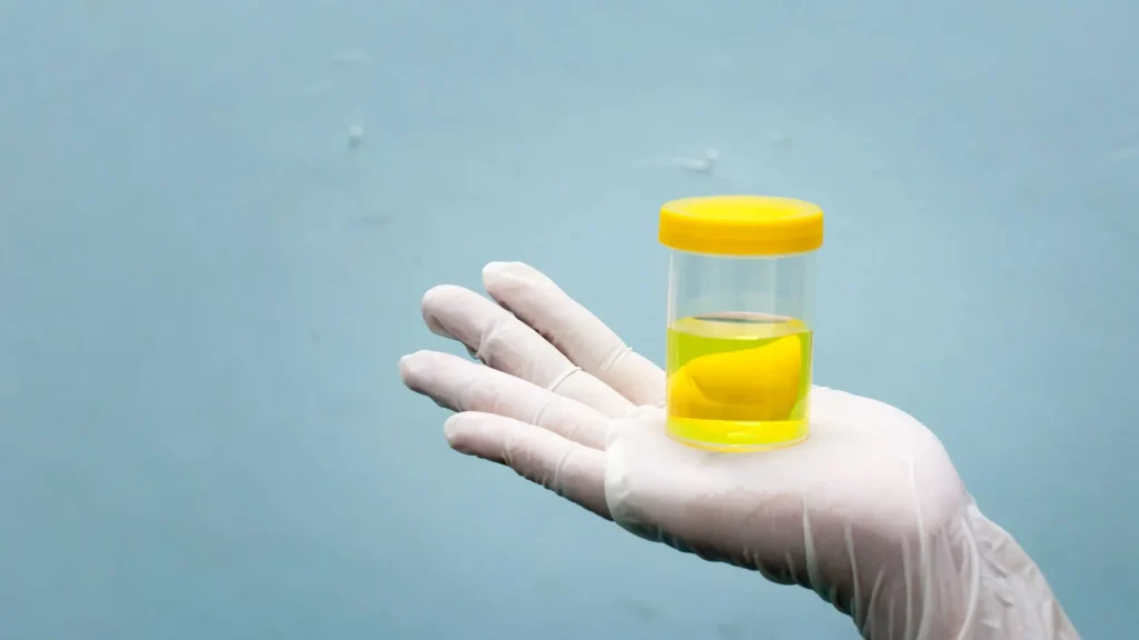 Penggunaan urine culture bottle harus dilakukan dengan tepat agar hasil yang diperoleh akurat.