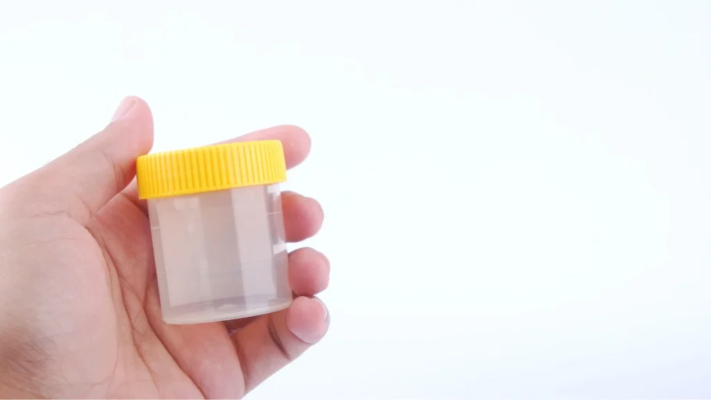 Prosedur steril sangat krusial dalam pengambilan sampel urin untuk kultur.