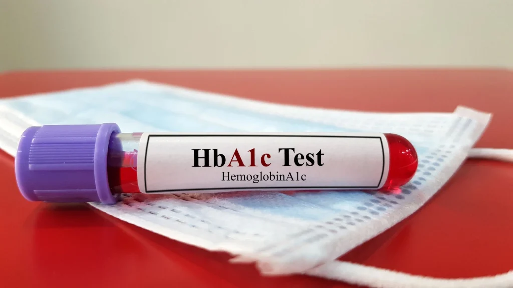 HbA1c, atau hemoglobin terglikasi, adalah parameter yang mencerminkan rata-rata kadar glukosa darah selama 2–3 bulan terakhir.