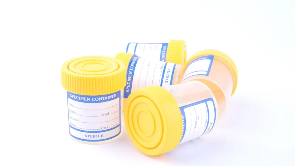 Infeksi saluran kemih (ISK) merupakan gangguan umum, terutama pada wanita.