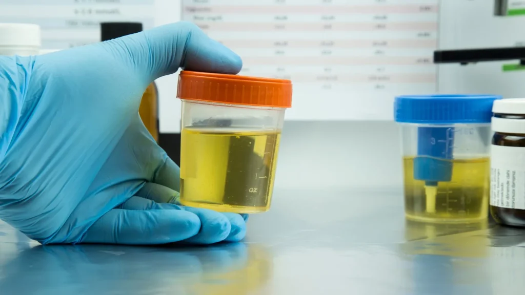 Urine culture bottle digunakan untuk mendeteksi keberadaan bakteri dalam urin, terutama pada kasus infeksi saluran kemih (ISK).