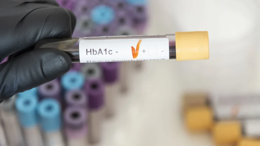 POCT HbA1c analyzer menjadi andalan dalam deteksi dan pemantauan diabetes secara cepat dan praktis.