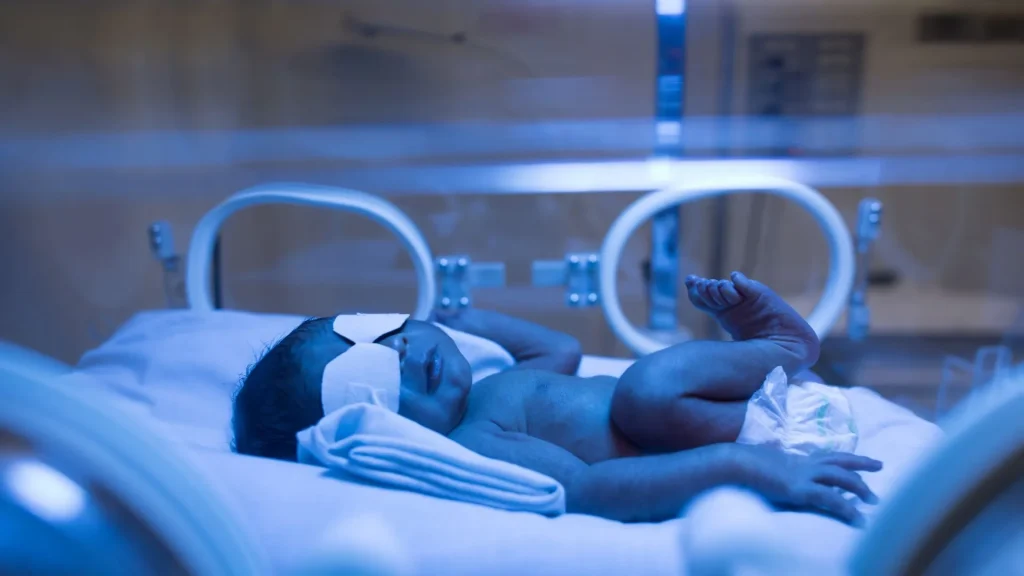 Bilirubin adalah pigmen berwarna kuning hasil pemecahan hemoglobin dari sel darah merah.