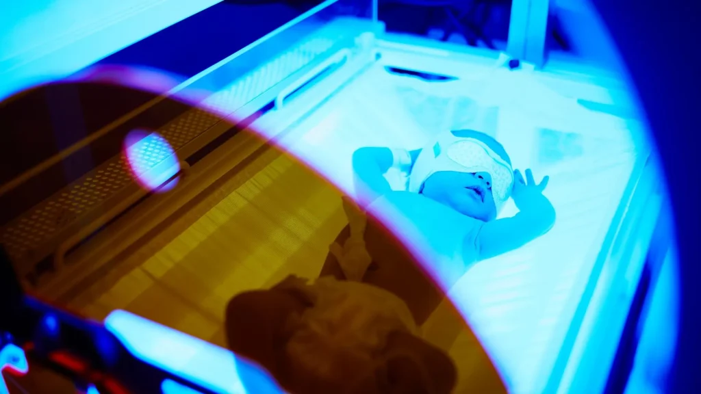 Hiperbilirubinemia adalah kondisi meningkatnya kadar bilirubin dalam darah bayi baru lahir.