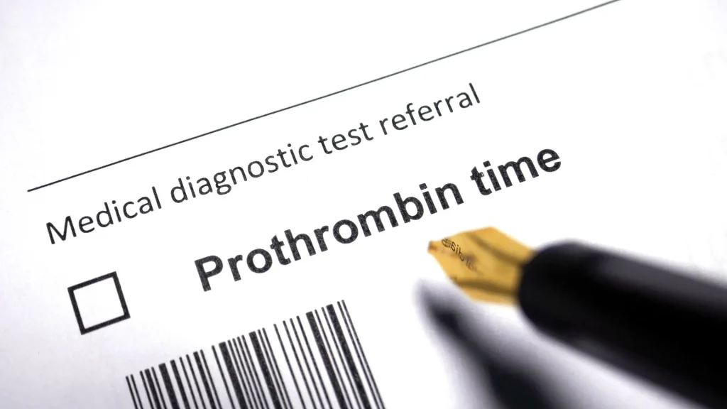 Prothrombin Time (PT) adalah waktu yang dibutuhkan darah untuk membeku setelah ditambahkan zat reagen tertentu.