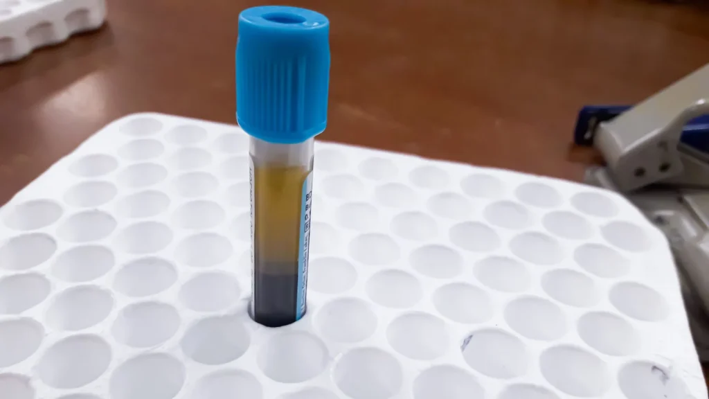 PT Analyzer adalah alat diagnostik laboratorium yang dirancang untuk mengukur Prothrombin Time (PT), yaitu waktu yang dibutuhkan darah untuk membeku.