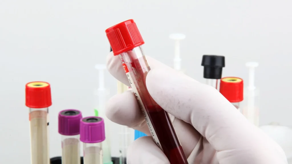 PT Analyzer adalah alat penting dalam mengukur Prothrombin Time (PT) dan INR, terutama untuk memantau terapi antikoagulan.