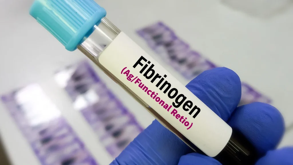 Risiko perdarahan merupakan salah satu perhatian utama dalam dunia medis, terutama pada pasien yang akan menjalani operasi, trauma berat, atau memiliki gangguan koagulasi.