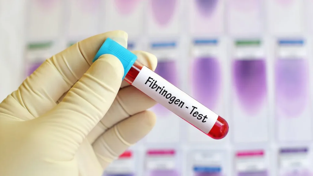 Fibrinogen Analyzer adalah perangkat diagnostik yang dirancang khusus untuk mengukur kadar fibrinogen dalam plasma darah.