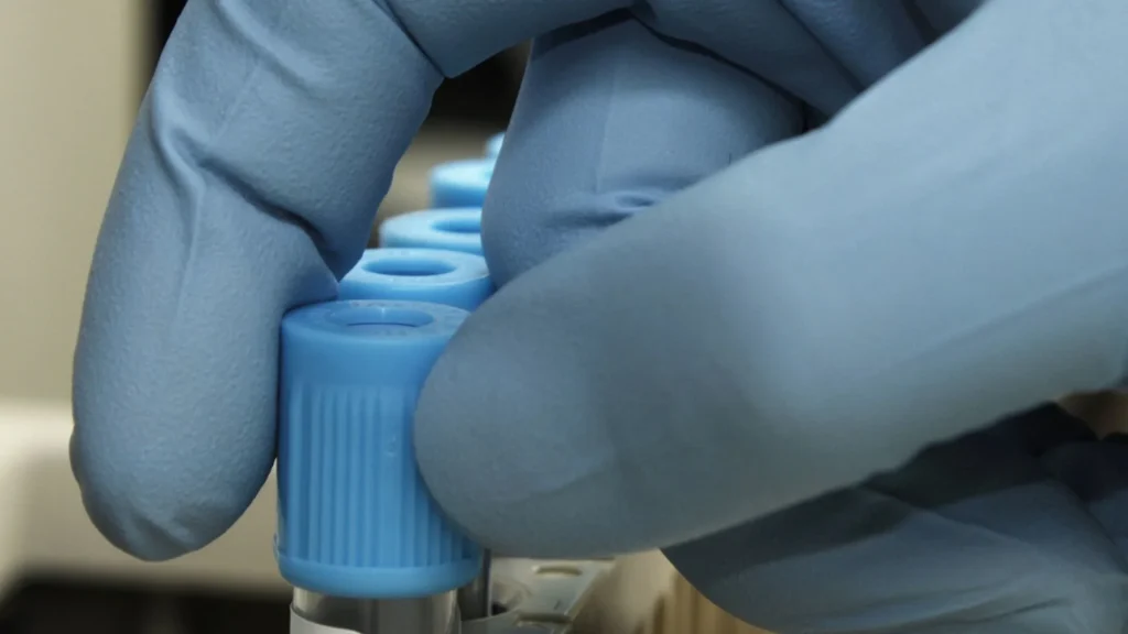 Tes fibrinogen merupakan salah satu pemeriksaan laboratorium penting untuk menilai kemampuan pembekuan darah seseorang.