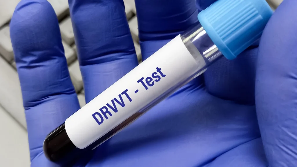 Fibrinogen adalah protein penting yang diproduksi oleh hati dan berfungsi dalam proses pembekuan darah.