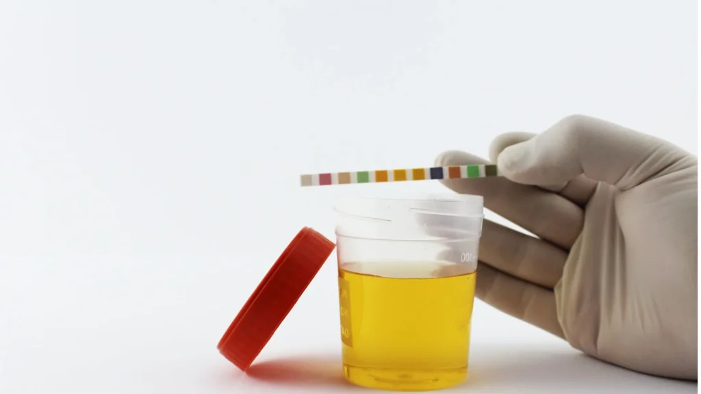 Specific gravity (SG) urin adalah ukuran konsentrasi zat terlarut dalam urin.