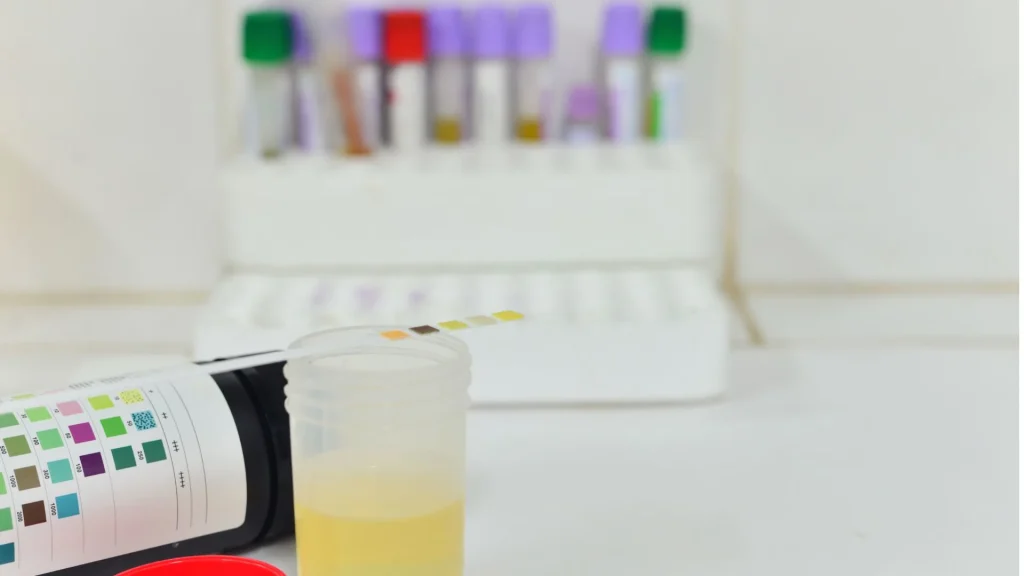 Pemeriksaan urine specific gravity (SG) kini tidak lagi hanya tersedia di laboratorium.