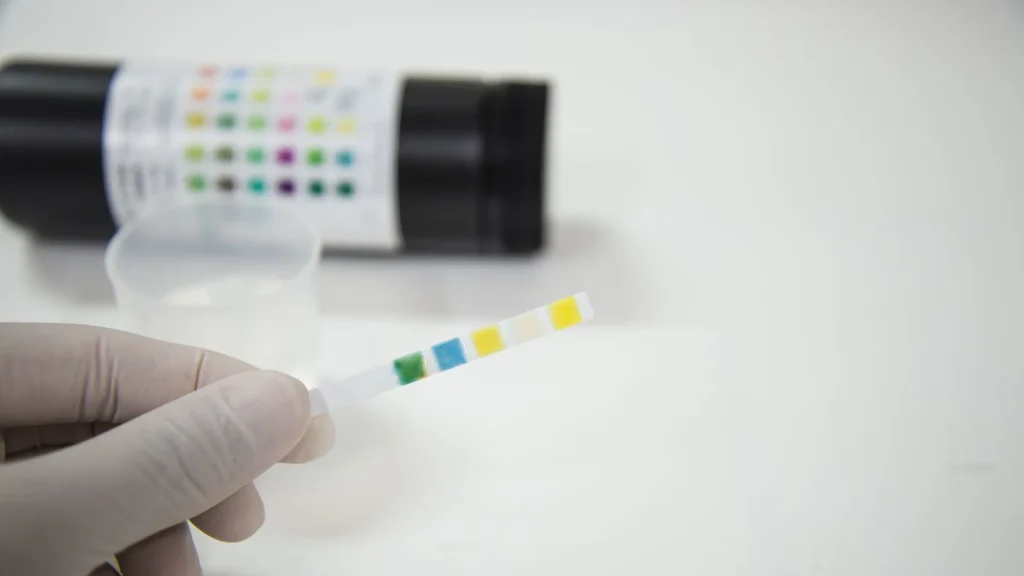 Berat jenis urin atau urine specific gravity (SG) adalah ukuran konsentrasi partikel dalam urin.