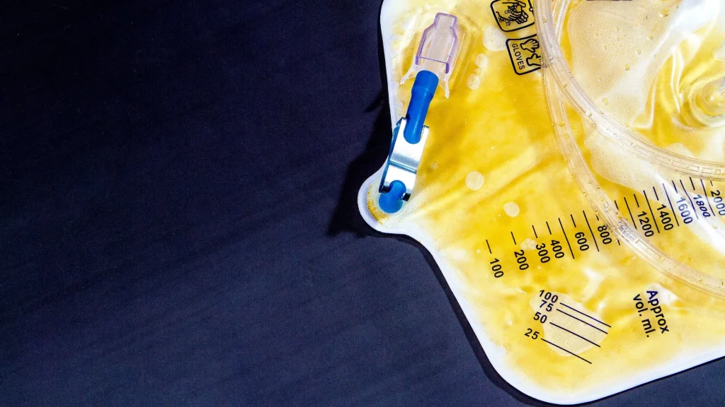 Urine flow meter adalah alat medis non-invasif yang digunakan untuk mengukur seberapa cepat dan seberapa banyak urin yang dikeluarkan saat buang air kecil.