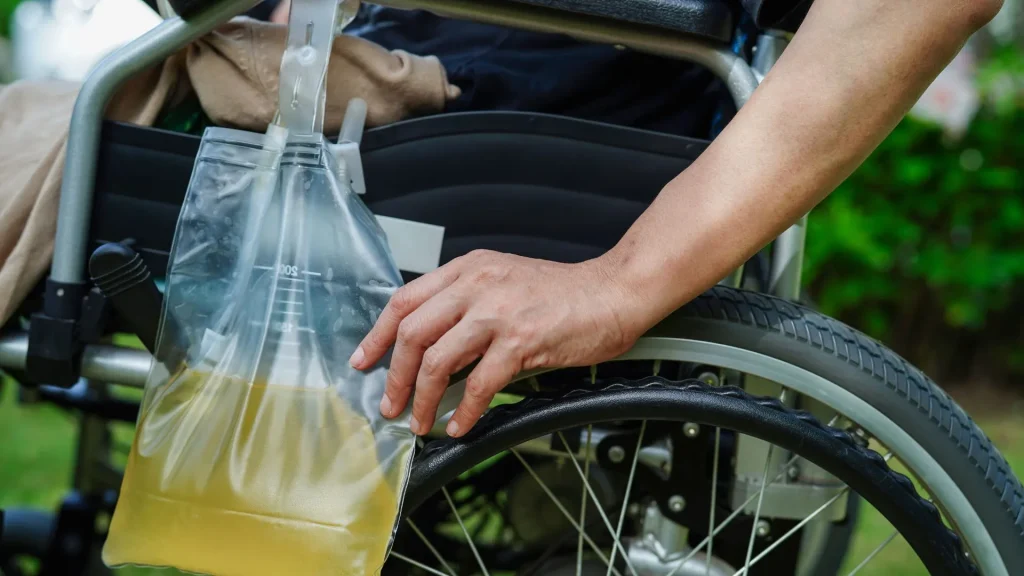 Urine flow meter adalah alat diagnostik non-invasif yang sering digunakan di klinik urologi untuk menilai gangguan saluran kemih.