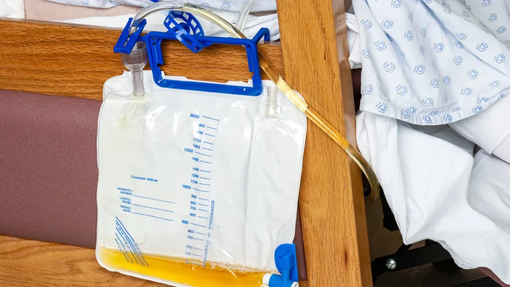 Pemeriksaan flow rate atau laju aliran urin adalah alat penting untuk mengevaluasi kesehatan saluran kemih, khususnya fungsi kandung kemih dan saluran keluar urin.