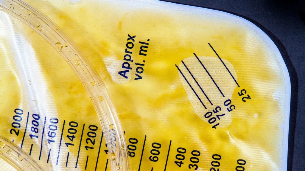 Urine flow meter adalah alat non-invasif yang digunakan untuk menganalisis pola buang air kecil seseorang.