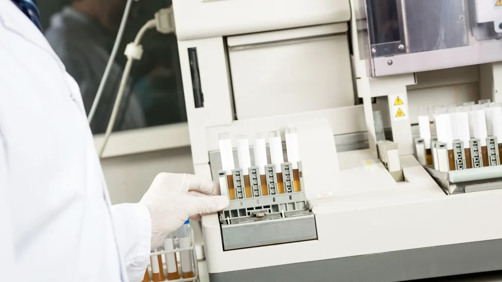 PCR Urine Analyzer mampu mendeteksi materi genetik mikroorganisme secara langsung dalam waktu singkat.