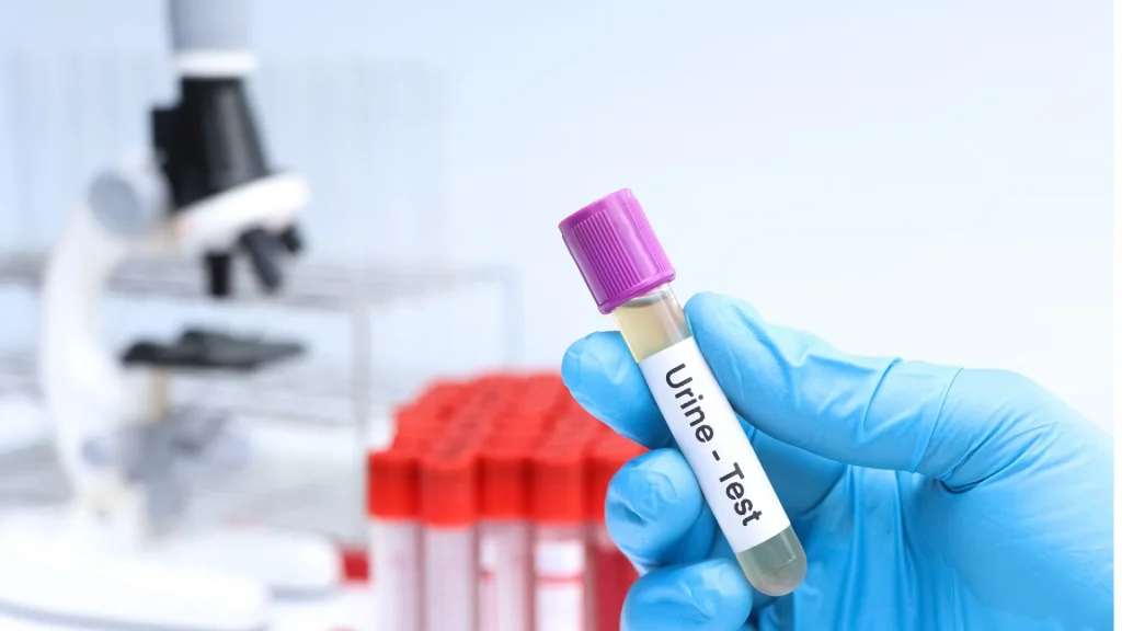 Teknologi PCR (Polymerase Chain Reaction) telah mengubah paradigma dalam pemeriksaan infeksi saluran kemih.