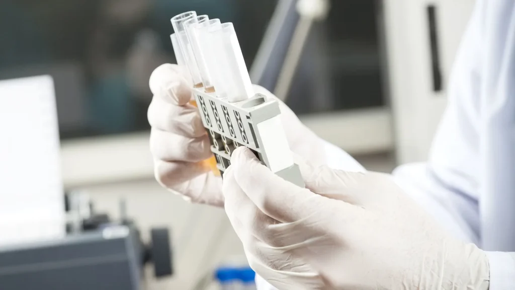 Penyakit Menular Seksual (PMS) merupakan kelompok infeksi yang sering kali tidak menimbulkan gejala awal.