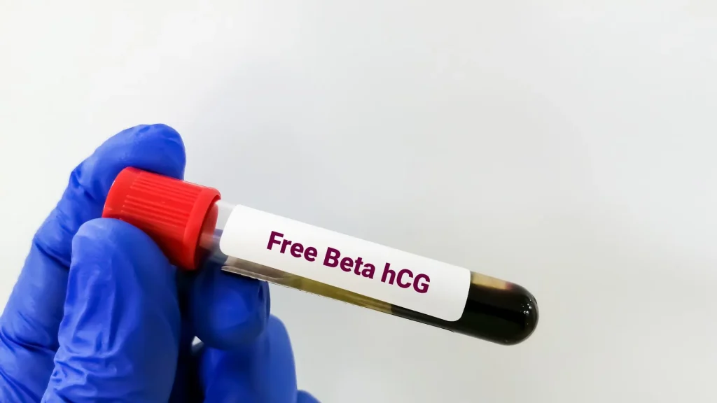 Beta-hCG Urine ELISA adalah metode laboratorium yang digunakan untuk mendeteksi keberadaan hormon human chorionic gonadotropin (hCG) dalam urin.