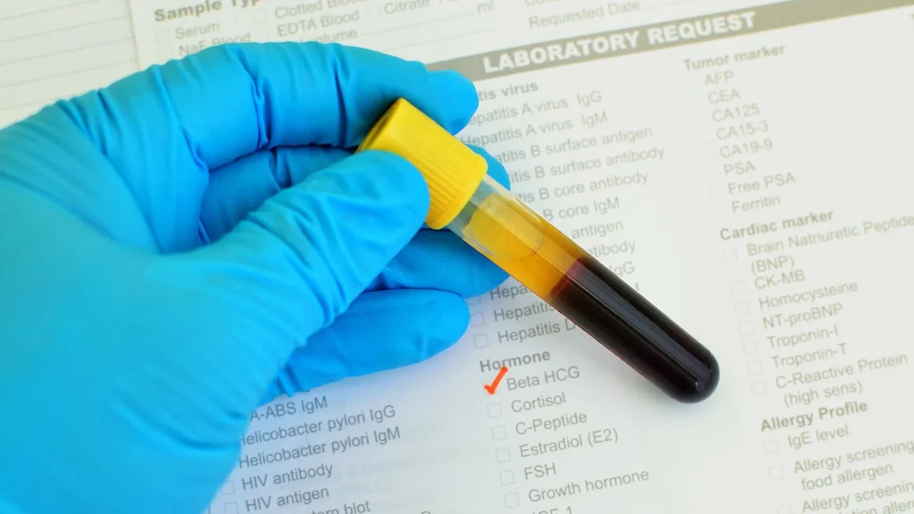 Beta-hCG Urine ELISA merupakan metode deteksi kehamilan berbasis laboratorium yang menggunakan teknik immunoassay untuk mengukur kadar hormon human chorionic gonadotropin (hCG) di dalam urin.