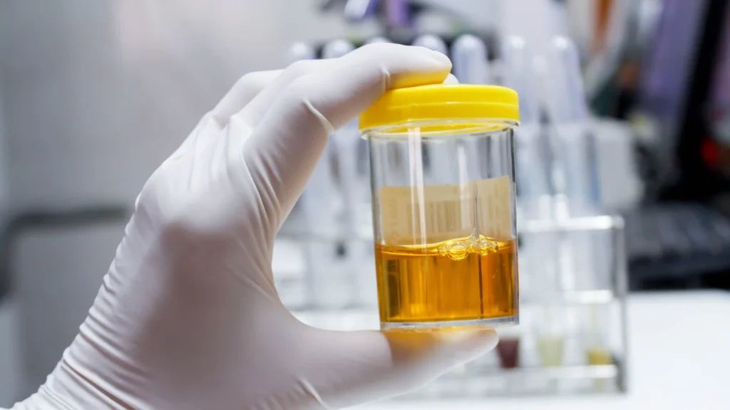 Beta-human chorionic gonadotropin (Beta-hCG) adalah hormon yang diproduksi oleh plasenta setelah implantasi embrio.