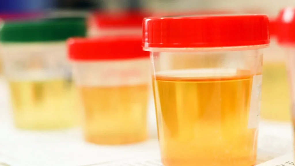 Urine Color Comparator adalah alat sederhana yang digunakan untuk membandingkan warna urin seseorang dengan skala warna standar.