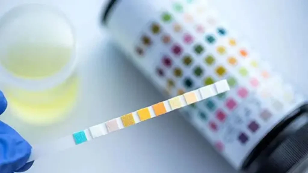 Urine Color Comparator adalah alat sederhana yang digunakan untuk membandingkan warna urin seseorang dengan skala warna standar.