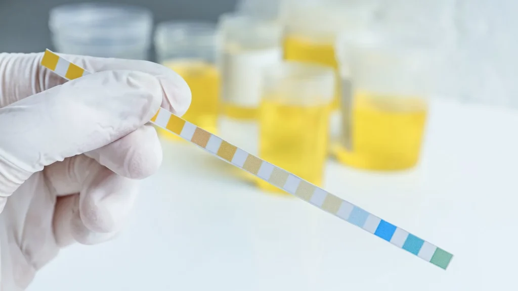 Infeksi saluran kemih (ISK) merupakan salah satu masalah kesehatan yang sering dijumpai di berbagai kelompok usia, terutama pada wanita.