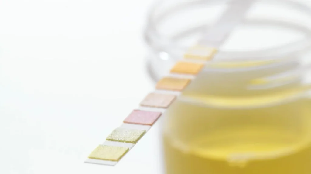 Leukocyte Esterase Test Strip merupakan alat sederhana yang banyak digunakan untuk mendeteksi leukosit dalam urin.