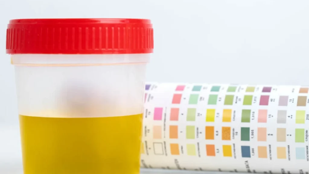 Pemeriksaan urin sering menjadi cara sederhana untuk menilai kondisi kesehatan, terutama dalam mendeteksi infeksi saluran kemih (ISK).