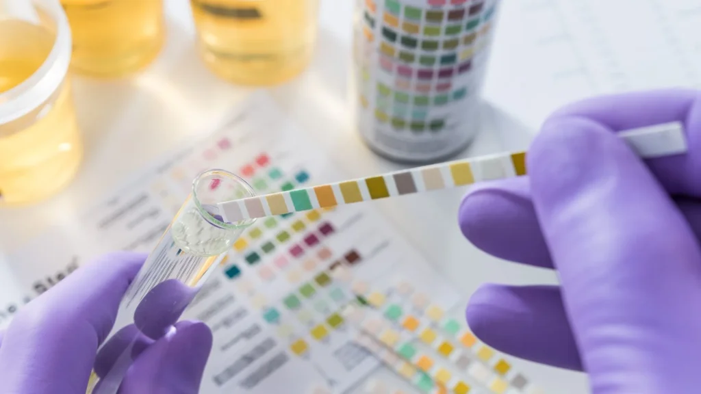 Infeksi saluran kemih (ISK) merupakan masalah kesehatan yang sering dialami terutama oleh lansia dan wanita aktif.