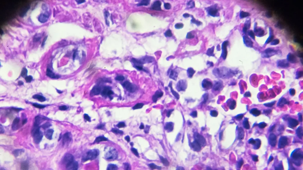 Pemeriksaan urin merupakan salah satu tes laboratorium paling sering dilakukan untuk mengevaluasi kesehatan seseorang.