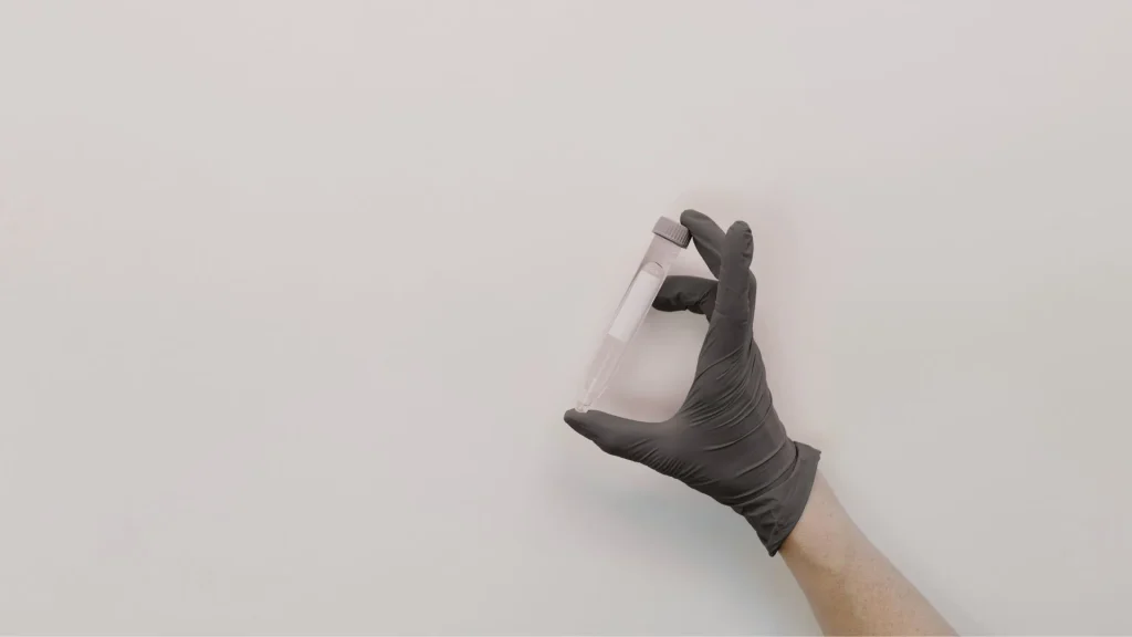 Analisis sedimen urin merupakan salah satu pemeriksaan laboratorium penting dalam mendiagnosis berbagai penyakit, mulai dari infeksi saluran kemih hingga gangguan ginjal.