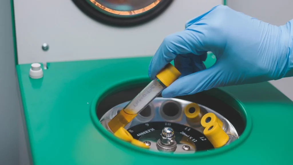 Dalam pemeriksaan laboratorium, tabung urin adalah wadah standar untuk menampung sampel.