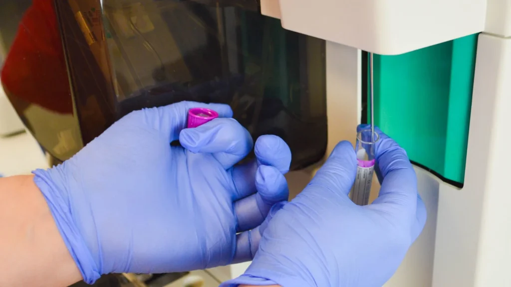 Pemeriksaan sedimen urin merupakan bagian penting dalam urinalisis yang membantu mendeteksi berbagai kelainan pada ginjal maupun saluran kemih.