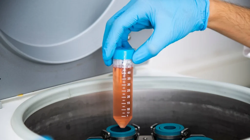 Fungsi ginjal yang optimal sangat penting bagi keseimbangan tubuh.