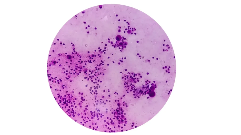 Urine cytology fixative memiliki peran penting dalam menjaga keutuhan sel untuk analisis sitologi.