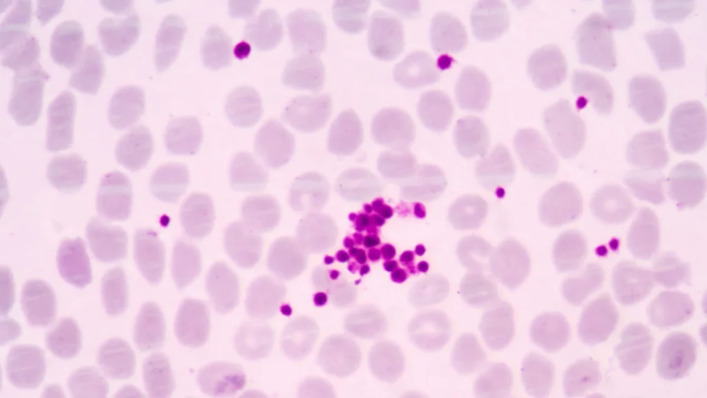 Dalam pemeriksaan sitologi urin, pemilihan metode penyimpanan sampel sangat menentukan kualitas hasil analisis.