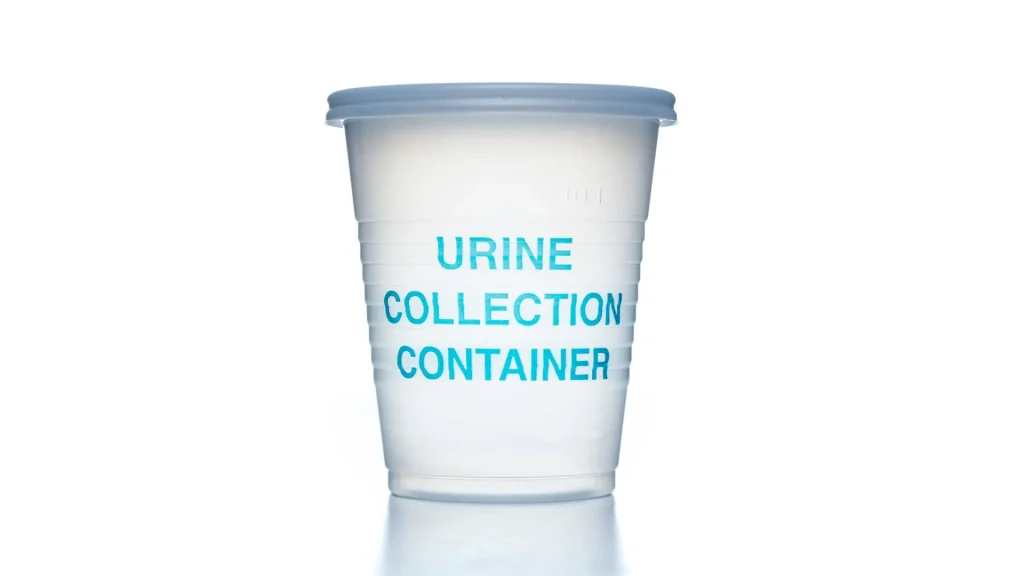 Sterile urine container atau wadah urin steril adalah perlengkapan penting dalam pemeriksaan laboratorium medis.