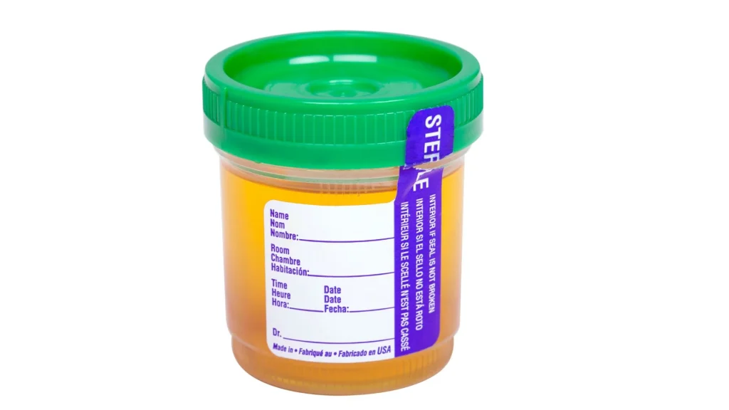 Pemilihan wadah urin sering dianggap sepele, padahal wadah yang digunakan dapat menentukan akurasi hasil pemeriksaan medis.