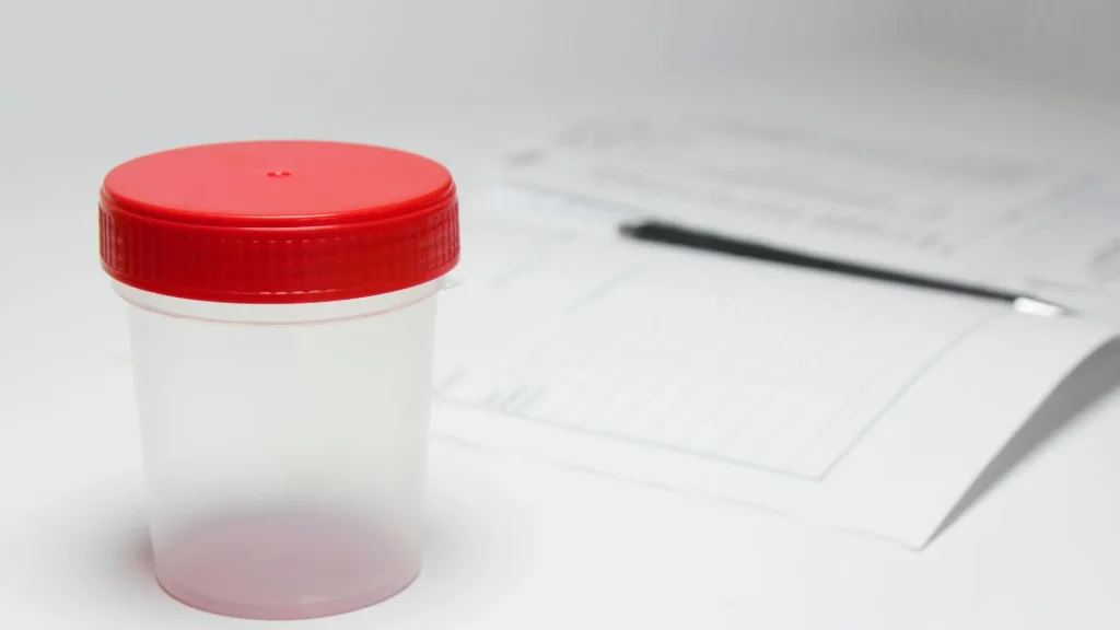 Sterile urine container merupakan wadah khusus yang dirancang untuk menyimpan sampel urin secara higienis.