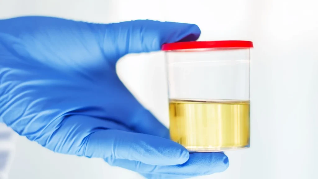 Sterile urine container adalah wadah khusus yang dirancang untuk menampung sampel urin dengan kondisi steril.