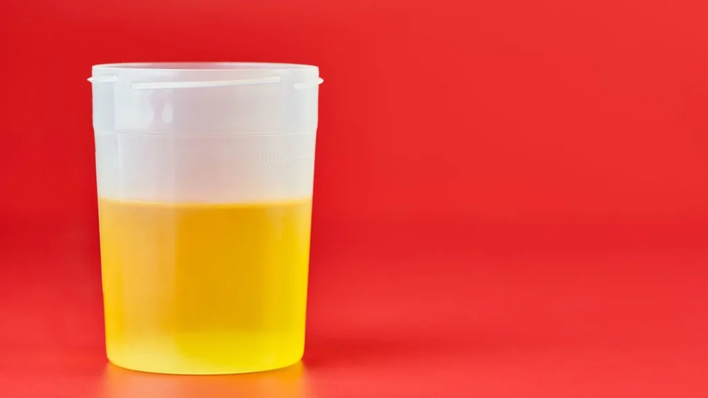 Sterile urine container adalah wadah khusus yang dirancang untuk menampung sampel urin dengan kondisi steril.