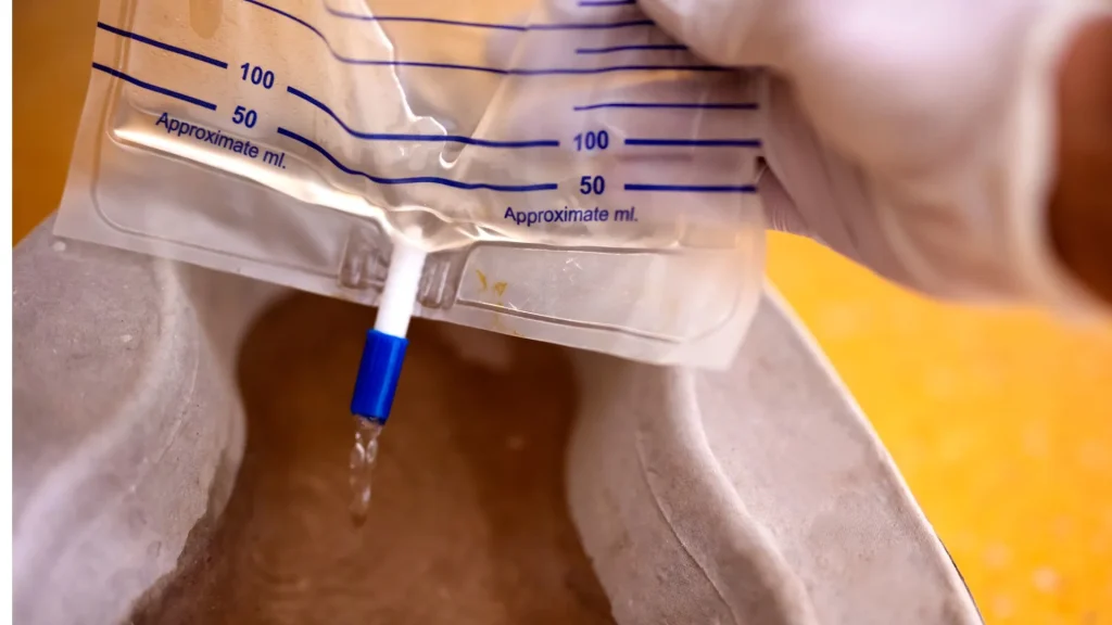 Urine transport bag sering kali dianggap hanya sebagai kantong sederhana, padahal perannya sangat vital dalam menjaga kualitas sampel urin untuk pemeriksaan klinis.